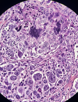 Mikroplasty: Vliv na reprodukci a vývoj plodu
